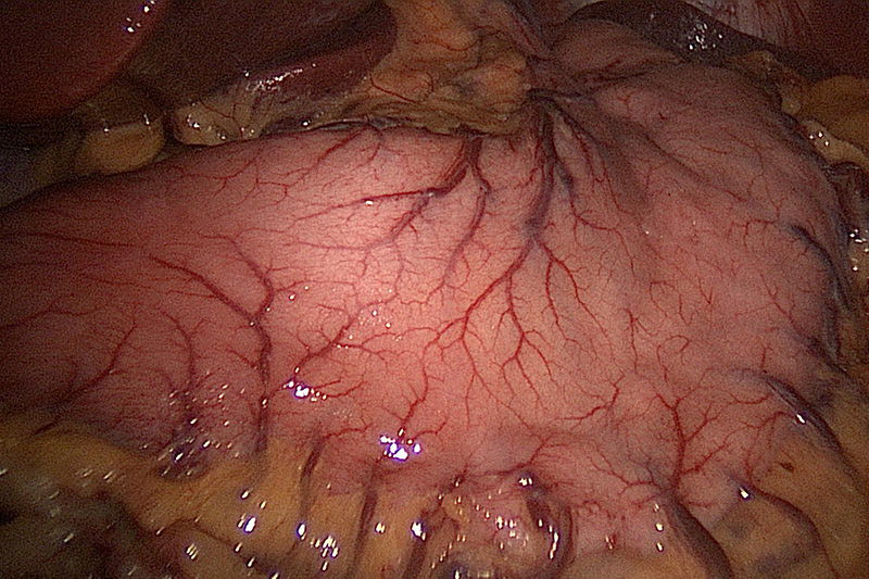 Surgical view of the stomach