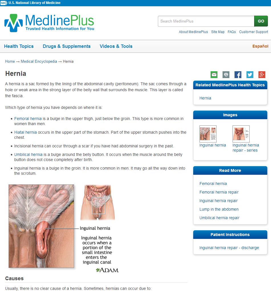 Información sobre la hernia de Medline