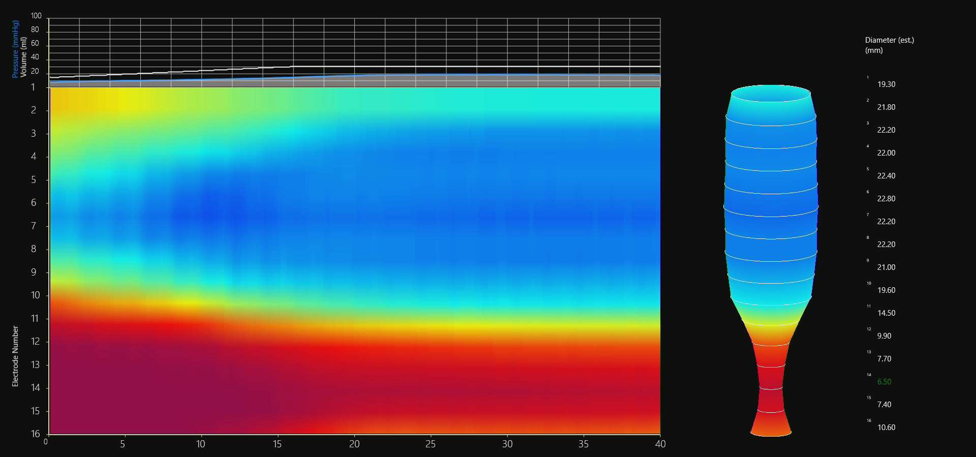 Esophageal Manometry