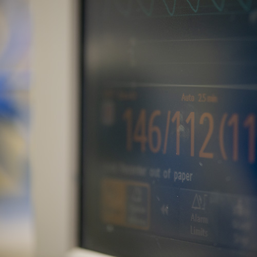BP monitor showing elevated readings