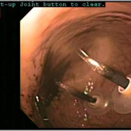 Intragastric Robotic Surgery Model