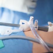 Operating Room Photos Camera in trocar for laparoscopic hernia